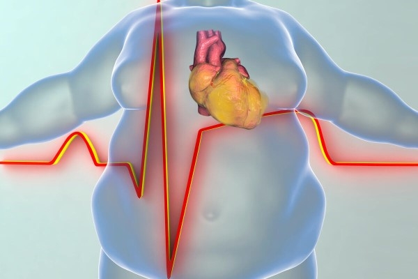Genel Cerrahi Uzmanı Prof. Dr. Fahri Yetişir Obezite kalp hastalıklarını tetikliyor